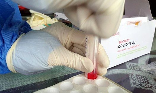 Cao điểm phòng chống dịch COVID-19, tỉnh Cà Mau có lúc khan hiếm kit test cục bộ. Ảnh: Minh Họa
