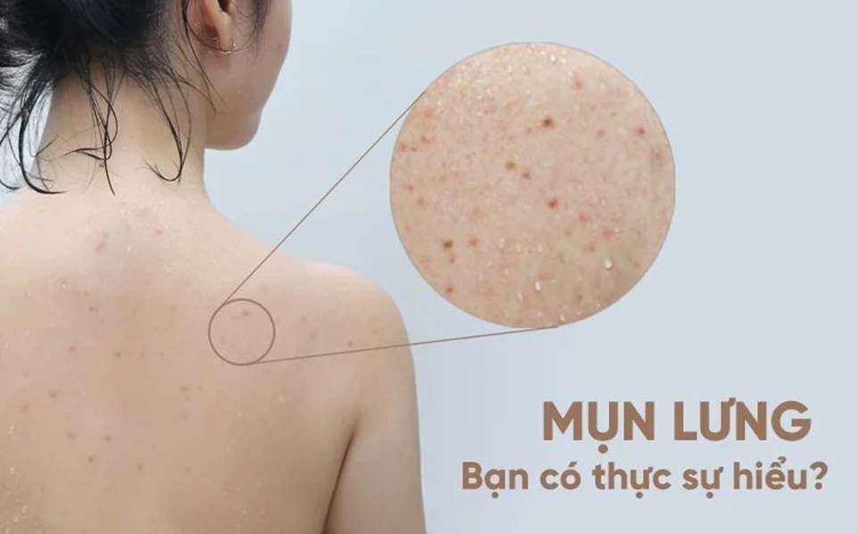 Ảnh: BVCC Ảnh: BVCC