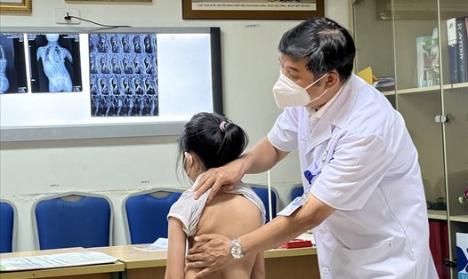 PGS.TS Đinh Ngọc Sơn khám cho một bé bị gù vẹo cột sống. Ảnh: BVCC