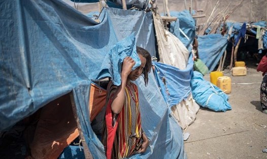 Trẻ em Ethiopia đối mặt nạn đói. Ảnh: AFP