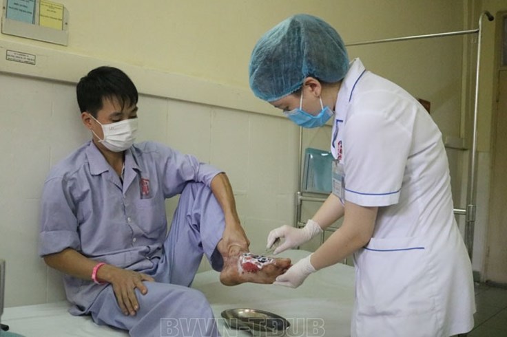 Người đàn ông bị nhiễm trùng bàn chân do điều trị sai cách Người đàn ông bị nhiễm trùng bàn chân do điều trị sai cách