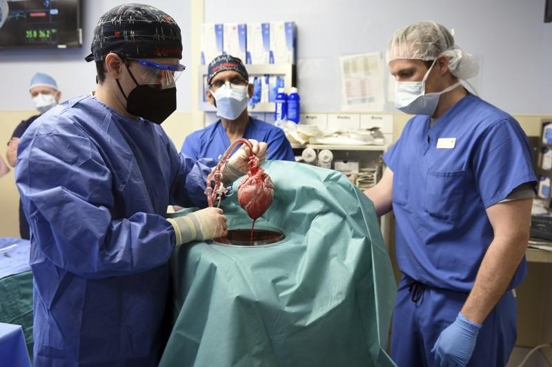 Shocking discovery in pig heart transplanted to humans
