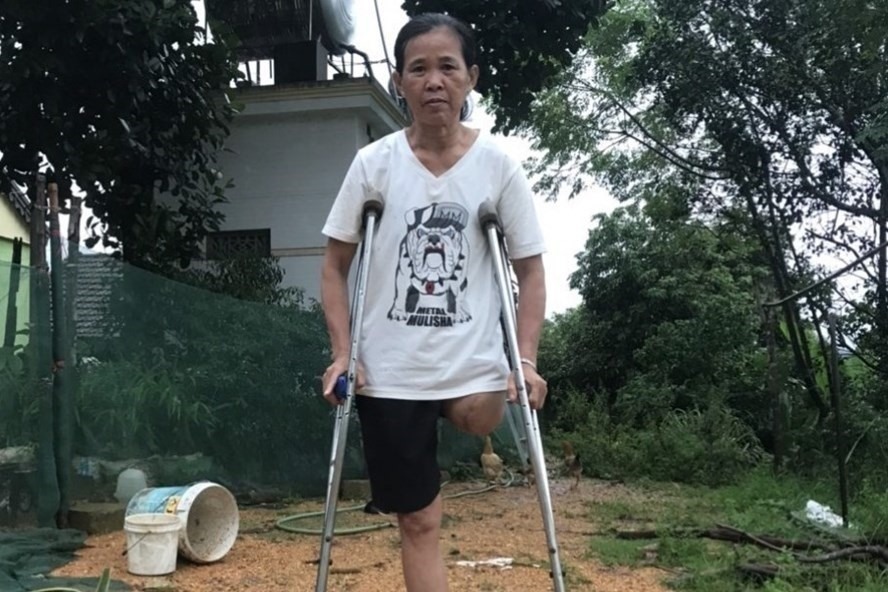 Bà Nguyễn Thị Tuyết (55 tuổi) trú xã Thanh Xuân, huyện Thanh Chương, tỉnh Nghệ An bị mất chân do tai nạn lao động. Ảnh: Phạm Thông