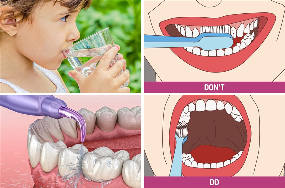 Khám nha định kỳ