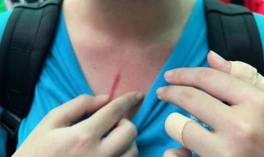 Hình ảnh vết xô xát cắt từ livestream của một phụ huynh tố con bị đánh tại Trường Quốc tế TPHCM - Học viện Mỹ đang lan truyền trên mạng xã hội những ngày gần đây - Ảnh chụp màn hình