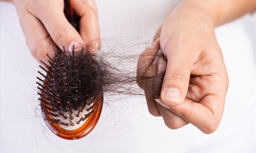 Phụ nữ sau sinh thường bị rụng tóc rất nhiều. Ảnh: Health