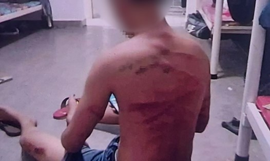 Một thanh niên bị tra tấn dã man khi nghe lời dụ dỗ qua Campuchia làm việc với mức thu nhập khủng. Ảnh cắt từ clip