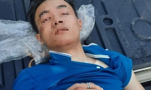 Nạn nhân Võ Văn Giáp (18 tuổi) trú xóm 7, xã Nghi Phong được phát hiện nằm tại nghĩa địa trong tình trạng bất tỉnh. Ảnh: HĐ