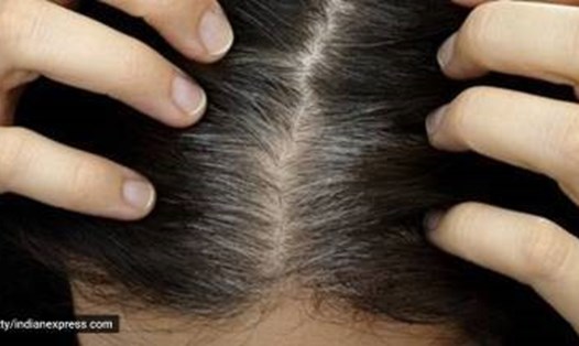 Bạn có đang mắc phải những sai lầm chăm sóc tóc này không? Ảnh: Getty Images/Thinkstock