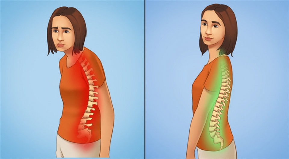 Đứng thẳng lưng khiến bạn tự tin và tràn đầy năng lượng hơn. Ảnh: Brightside