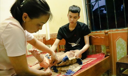 Em Phan Nguyễn Thành Long gầy gò, đôi chân tong teo sau nhiều tháng nằm viện điều trị. Ảnh: Đức Tuấn