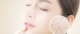 Dùng retinol để góp phần chống lão hóa da. Ảnh: ST