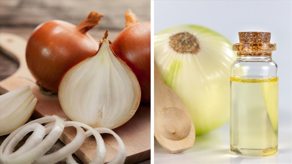 Nước ép hành tây có tác động tích cực có sự phát triển của tóc. Đồ họa: Như Ý