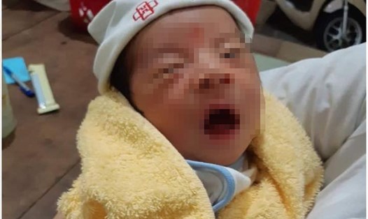 Bé trai khoảng 10 ngày tuổi bị bỏ rơi ở cửa chùa đang được Trạm Y tế phương Đức Thuận chăm sóc. Ảnh: HL.