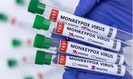 Các ống nghiệm cho thấy kết quả dương tính/âm tính với virus đậu mùa khỉ. Ảnh: Reuters