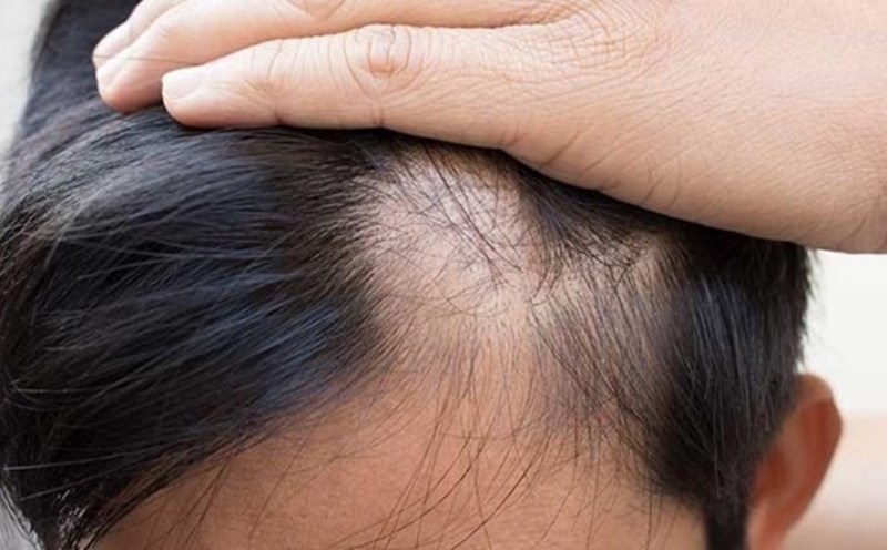 Bạn từng nghe đến ngộ độc thuốc nhuộm tóc, nhưng đừng lo! Những hình ảnh mới nhất sẽ giúp bạn hiểu rõ hơn về cách phòng tránh tình trạng này và giữ vóc dáng của mái tóc bạn.