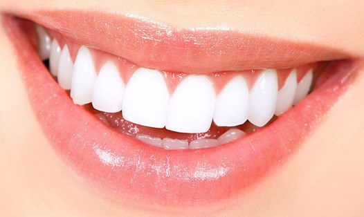 Giữ vệ sinh răng miệng là mẹo để có được một nụ cười tự tin. Ảnh: evdp.net