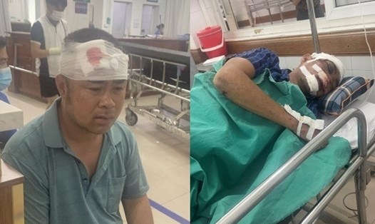 2 công nhân của Công ty Cổ phần Nhẫn đang phải điều trị tại Bệnh viện Việt Đức. Ảnh: CTV