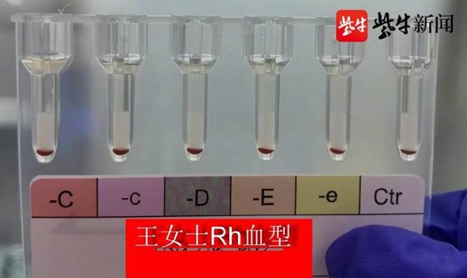 Trung Quốc phát hiện thêm 2 người có nhóm máu Rhnull. Ảnh chụp màn hình Weibo.