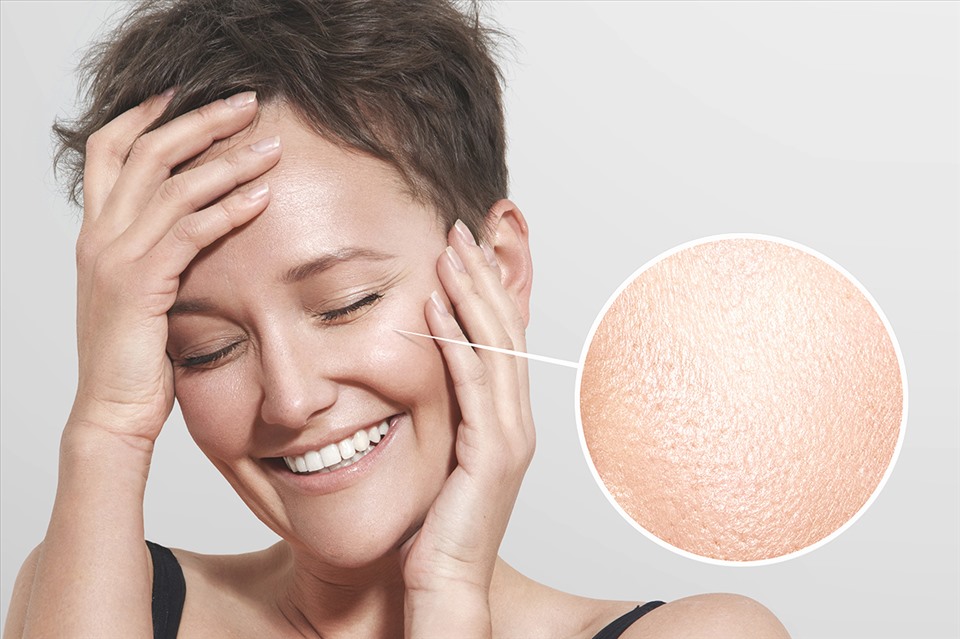 Có nhiều nguyên nhân gây ra tình trạng lỗ chân lông to. Ảnh: Dr Rachel Ho