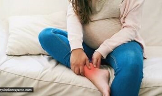 Huyết khối tĩnh mạch sâu có thể gây sưng phù quá mức ở tay chân và gây đau nhức, vì vậy bạn cần đi thăm khám bác sĩ. Ảnh: Getty/Thinkstock