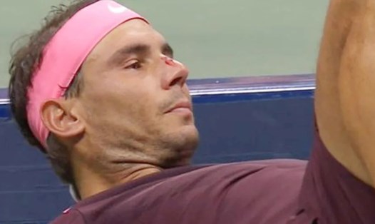 Rafael Nadal đổ máu vì tai nạn bất ngờ ở trận đấu với Fabio Fognini tại vòng 2 US Open. Ảnh: Marca