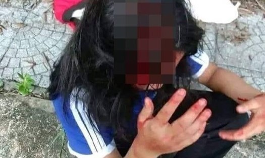 Hai nữ sinh tại huyện Phú Lộc (Thừa Thiên Huế) đánh nhau vì mâu thuẫn. Nữ sinh T.T.H.L bị đánh chảy máu vùng đầu. Ảnh cắt từ clip.