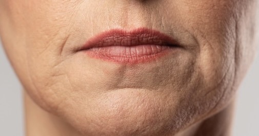 Có nhiều nguyên nhân dẫn đến tình trạng da lão hoá sớm. Ảnh: ST