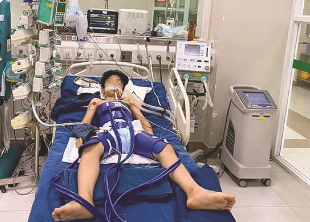 Bệnh nhân M được các bác sĩ điều trị tích cực và theo dõi sát tránh các biến chứng thứ phát tại khoa Điều trị tích cực Nội khoa, Bệnh viện Nhi Trung ương. Ảnh: Lê Hiếu