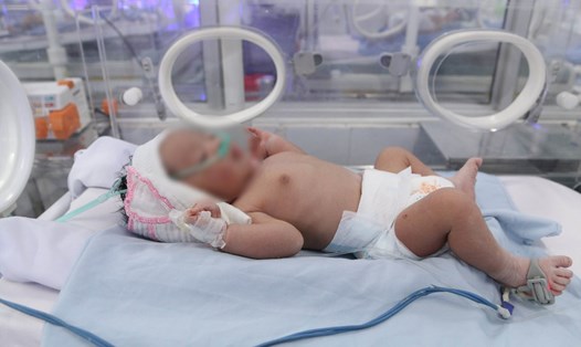 Tình trạng sức khỏe bé ổn định, được chăm sóc, nuôi dưỡng tại khoa Sơ sinh Bệnh viện Phụ sản Hải Phòng. Ảnh: Bệnh viện Phụ sản Hải Phòng