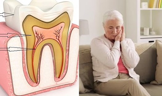 Vấn đề sức khỏe răng miệng ở người cao tuổi. Đồ họa: Thanh Thanh 