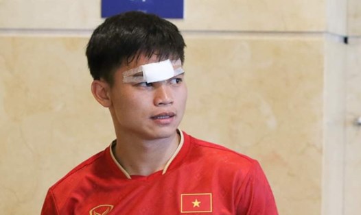 Hậu vệ Hồ Văn Cường khâu 7 mũi sau chấn thương trong trận đấu với tuyển Trung Quốc. Ảnh: VFF