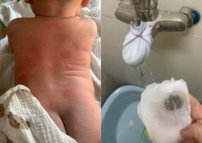 Bổ sung nguồn cấp nước sạch cho Khu đô thị Thanh Hà sau vụ người dân nổi mẩn ngứa