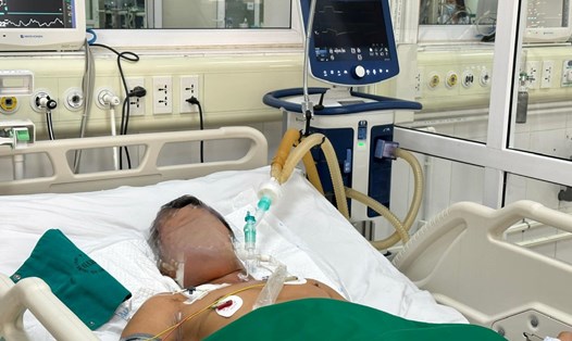 Bệnh nhân mắc uốn ván đang điều trị tại Bệnh viện Bệnh Nhiệt đới Trung ương. Ảnh: Bệnh viện cung cấp