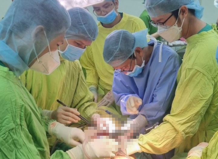 Các bác sĩ của Bệnh viện đa khoa Trung ương Cần Thơ tiến hành phẫu thuật xuyên đêm cứu bệnh nhân P. Ảnh: Bệnh viện cung cấp