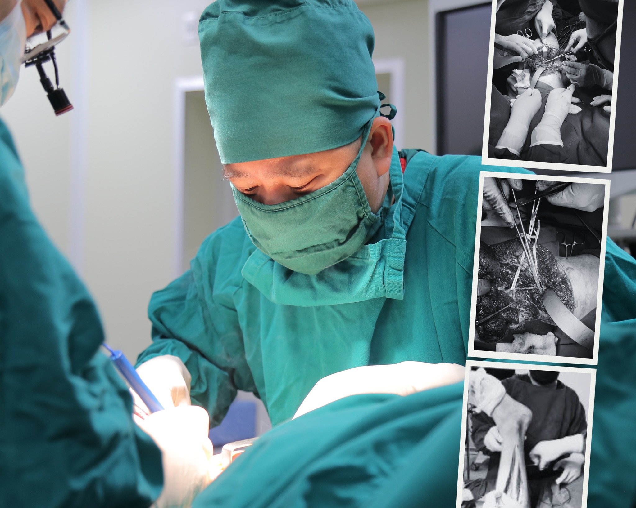 Bác sĩ thực hiện ca phẫu thuật. Ảnh: BVCC