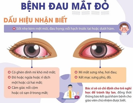 Tài liệu truyên truyền về cách nhận biết đau mắt đỏ. Ảnh: Sở Thông tin Truyền thông Cà Mua cung cấp