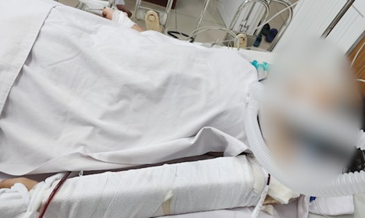 Bệnh nhân đa chấn thương được bác sĩ cấp cứu kịp thời. Ảnh: Nguyễn Ly