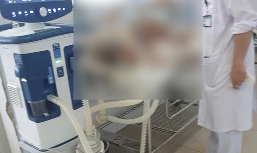 Một nạn nhân bị bỏng do xăng được đưa đến Bệnh viện Đa khoa tỉnh Ninh Thuận điều trị. Ảnh: Vy Vy