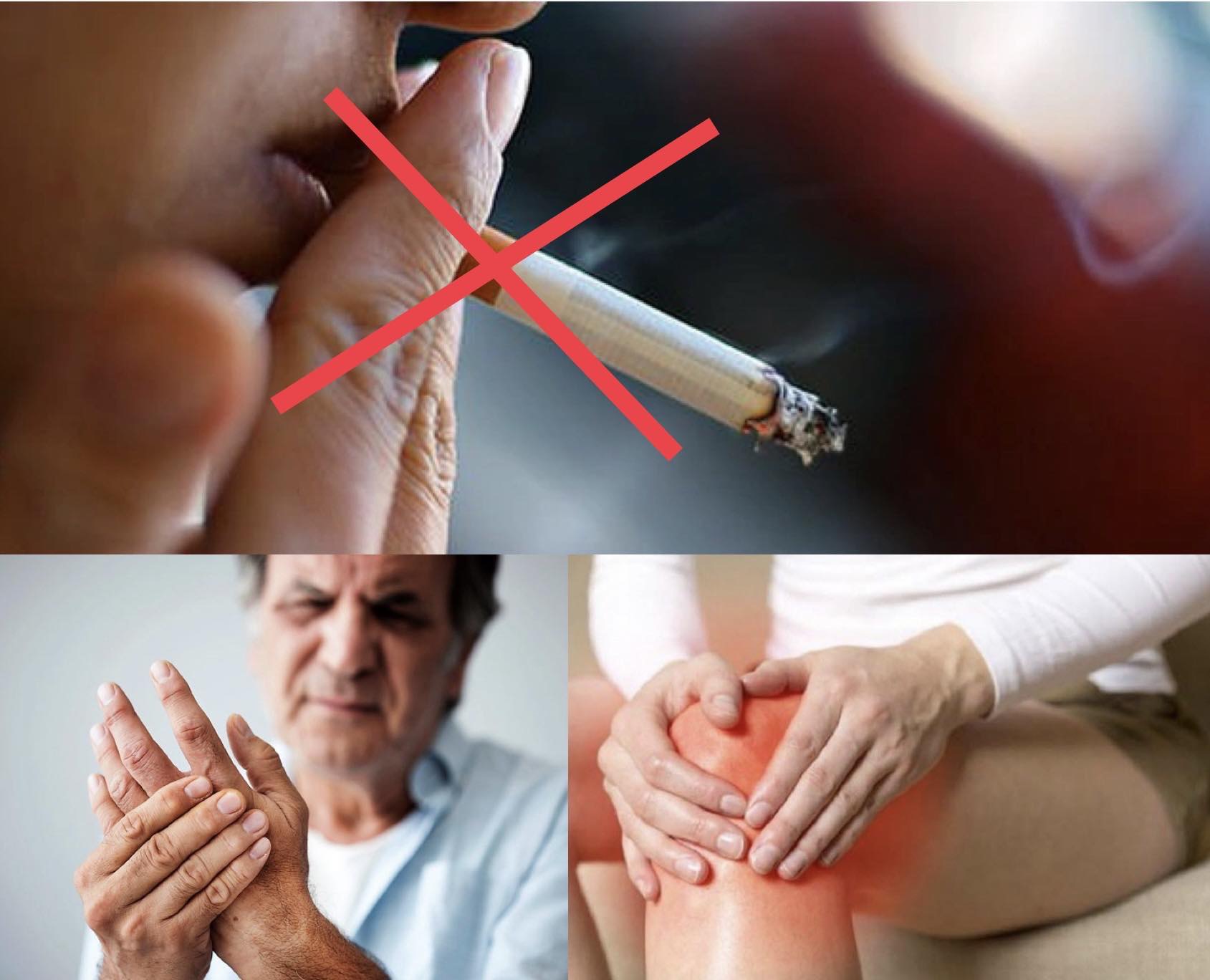 Hút thuốc làm trầm trọng thêm bệnh viêm khớp dạng thấp. Đồ họa: Hương Giang