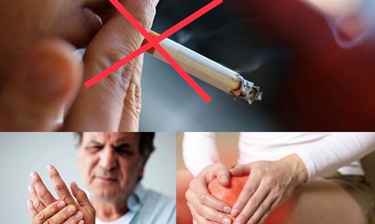 Hút thuốc làm trầm trọng thêm bệnh viêm khớp dạng thấp. Đồ họa: Hương Giang