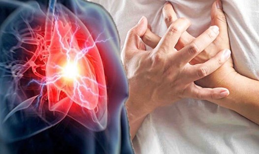 Người bị nhồi máu cơ tim có nhiều dấu hiệu trước khi phát hiện bệnh. Đồ hoạ: Hạ Mây