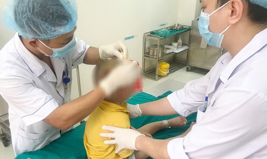 Bệnh nhi bị chó cắn cấp cứu tại Bệnh viện Nhi Thanh Hóa. Ảnh: Quách Du