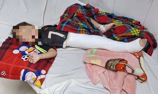 Bé trai 2 tuổi bị thương nặng sau vụ tai nạn giao thông đang nằm điều trị tại bệnh viện. Ảnh: Uy Nguyễn