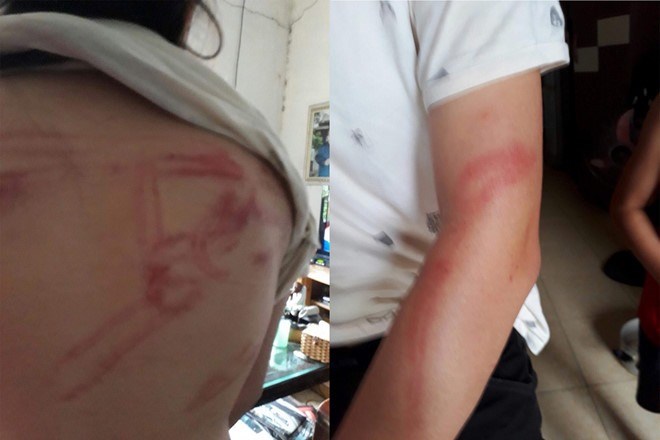 Bạo lực giữa người từng là cha nuôi, con nuôi có phải là bạo lực gia đình?
