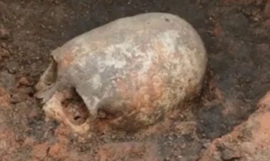 Các nhà khảo cổ đã phát hiện dấu hiệu phẫu thuật não trên các bộ hài cốt người cổ đại từ 3.200 năm trước tại Thổ Nhĩ Kỳ. Ảnh: Chụp màn hình