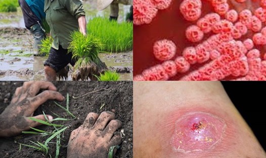 Vi khuẩn gây bệnh Whitmore sống trong bùn đất, nước bị ô nhiễm. Ảnh đồ họa: Hương Giang