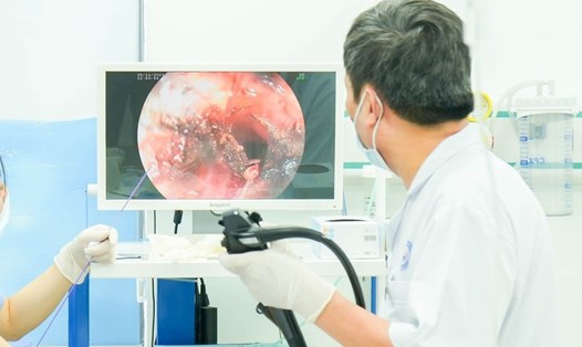 Các bác sĩ nội soi gắp dị vật trong thực quản cổ bệnh nhi. Ảnh: Bệnh viện Quốc tế Sản nhi Hải Phòng