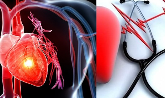 Tăng huyết áp cũng là nguyên nhân lớn dẫn đến bệnh lý tim mạch. Ảnh ghép: Nguyễn Ly 