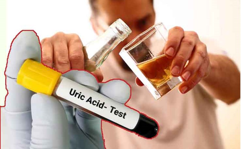 Chỉ số axit uric 540 - Tìm hiểu sự ảnh hưởng và những điều cần biết